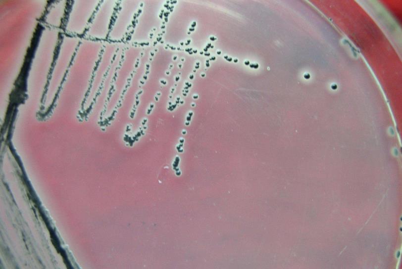 多品牌餐企陷食安風(fēng)波，如何保障餐飲行業(yè)食品安全？